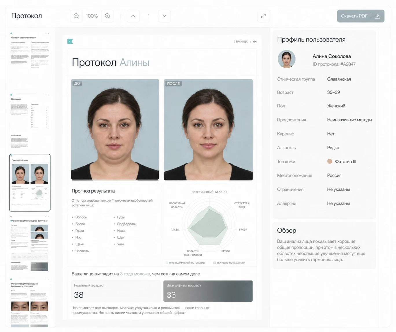 Отчёт Beautify по второму подбородку